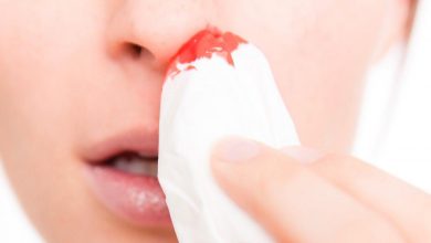 چگونه می توان خونریزی از بینی را درمان کرد؟