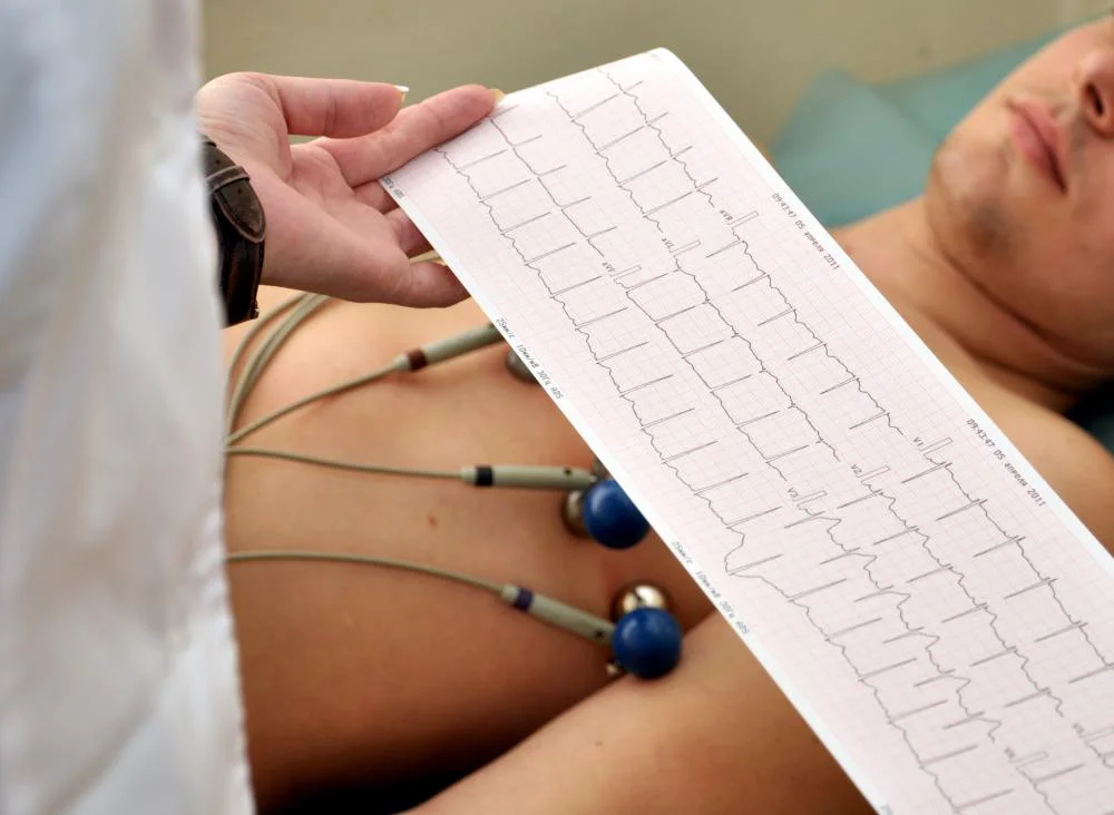 نوار قلب دریافت شده از ECG