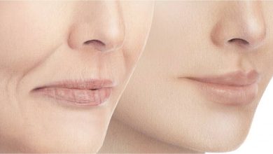فیلرها: پُر کننده چین و چروک