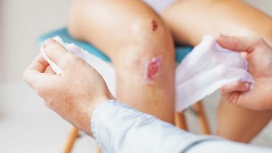 چرک چگونه به وجود می آید؟