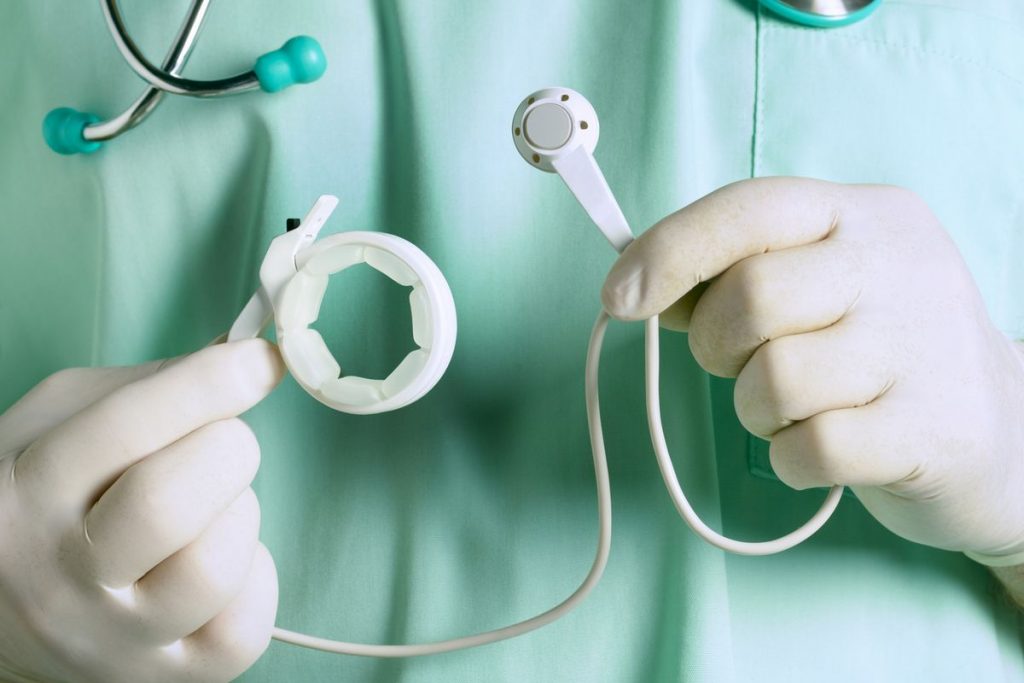 جاگذاری حلقه معده