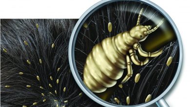 آنچه که از شپش باید بدانید