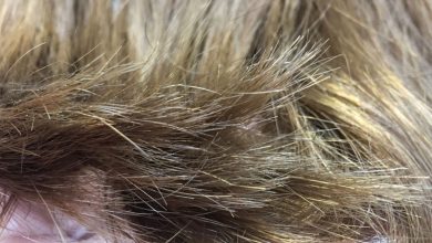 موخوره چیست؟