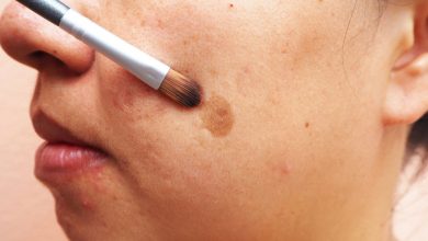 با بیماری ملاسما آشنا شوید