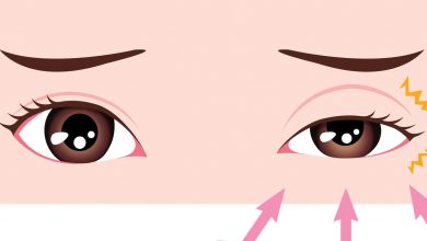 پرش پلک چشم چیست؟