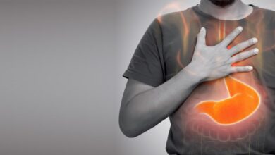 سوزش سر دل چیست؟